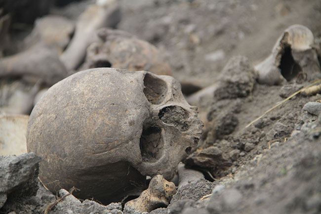 ardahan’da-kafatasi-ve-insan-kemikleri-bulundu-(2).jpg